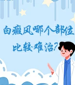 白癜风知识