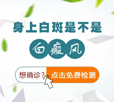 咨询白斑是不是白癜风
