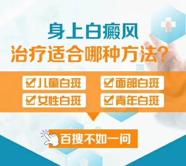 咨询白癜风治疗方法